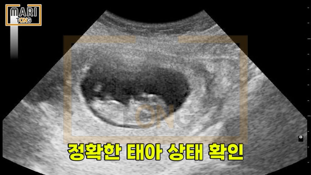 강아지 동물병원 강아지 출산 시 초음파, 엑스레이 